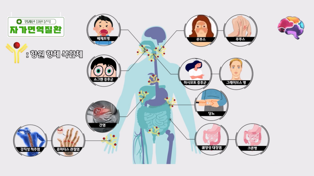 자가면역질환은 면역계가 어떤 세포를 공격하는가의 차이일 뿐, 자기 조직을 공격하는 경향성은 동일합니다.